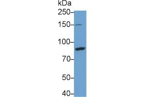 Detection of IkBKb in THP1 cell lysate using Polyclonal Antibody to Inhibitor Of Kappa-Light Polypeptide Gene Enhancer In B-Cells Kinase Beta (IkBKb) (IKBKB antibody  (AA 246-528))