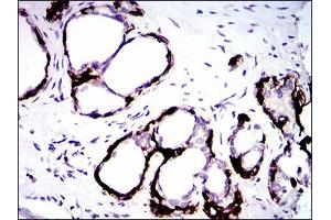 Immunohistochemistry (IHC) image for anti-Keratin 5 (KRT5) (AA 316-590) antibody (ABIN1724789)