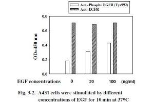 Image no. 7 for Epidermal Growth Factor Receptor (EGFR) ELISA Kit (ABIN1981829)