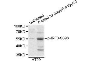 Western blot analysis of extracts of HT29 cells, using Phospho-IRF3-S396 antibody. (IRF3 antibody)