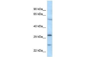 Western Blot showing MAD2L1BP antibody used at a concentration of 1 ug/ml against MDA-MB-435S Cell Lysate (MAD2L1BP antibody  (N-Term))