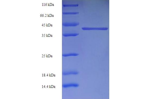 GABRA4 Protein (AA 36-258) (His-SUMO Tag)