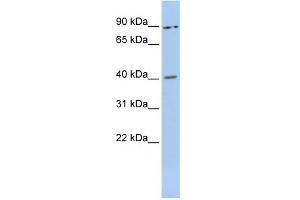 WB Suggested Anti-MEIS3 Antibody Titration:  0. (MEIS3 antibody  (Middle Region))