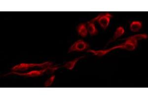 ABIN6267300 staining HepG2 by IF/ICC. (Integrin beta 3 antibody  (pTyr785))