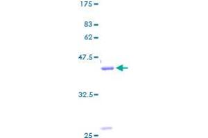 Image no. 1 for Gastrin-Releasing Peptide (GRP) (AA 1-148) protein (GST tag) (ABIN1355796) (Gastrin-Releasing Peptide Protein (GRP) (AA 1-148) (GST tag))