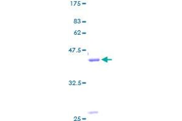 Gastrin-Releasing Peptide Protein (GRP) (AA 1-148) (GST tag)