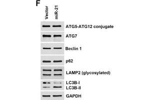 Western Blotting (WB) image for anti-Sequestosome 1 (SQSTM1) antibody (ABIN2854836)