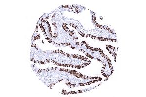 fallopian tube mucosa (Recombinant Cytokeratin 7 antibody  (AA 1-100))