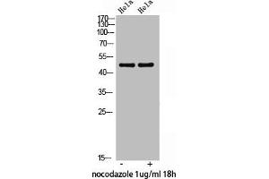 Western Blot analysis of HeLa nocodazole 1 μg/mL 18h cells using Phospho-p47-phox (S359) Polyclonal Antibody (NCF1 antibody  (pSer359))