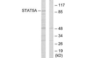 Western Blotting (WB) image for anti-Signal Transducer and Activator of Transcription 5A (STAT5A) (Internal Region) antibody (ABIN1849360) (STAT5A antibody  (Internal Region))
