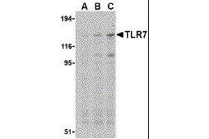 Western Blotting (WB) image for anti-Toll-Like Receptor 7 (TLR7) antibody (ABIN2476854) (TLR7 antibody)