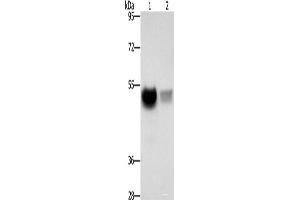 Western blot analysis of Mouse brain tissue PC3 cells using CREBZF Polyclonal Antibody at dilution of 1:500 (CREBZF antibody)