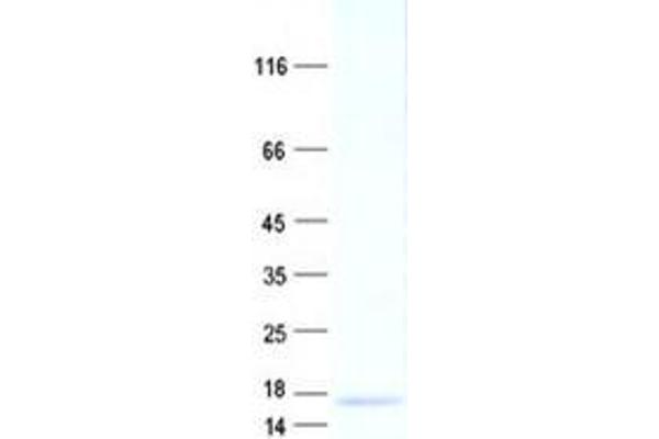 ADAMTSL1 Protein (His tag)