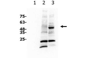 Western Blotting (WB) image for anti-Solute Carrier Family 7, (Cationic Amino Acid Transporter, Y+ System) Member 11 (SLC7A11) antibody (ABIN6655336)