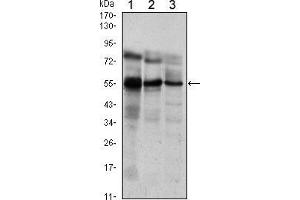 Western Blot showing ETV5 antibody used against Jurkat (1), NIH/3T3 (2) and MCF-7 (3) cell lysate. (ETV5 antibody)