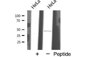 Western blot analysis of GATA6 expression in HeLa cells (GATA6 antibody  (Internal Region))