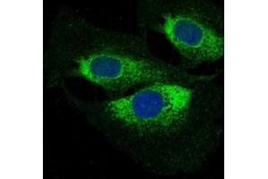 Immunofluorescent analysis staining in HeLa cells. (DAPI Staining Kit)