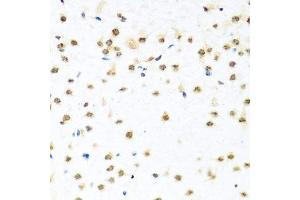 Immunohistochemistry of paraffin-embedded mouse brain using RAB3IP antibody. (RAB3IP antibody  (AA 1-150))