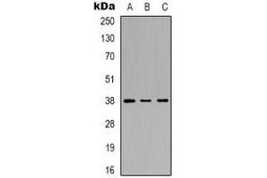 Western blot analysis of p38 expression in Hela (A), HepG2 (B), PC3 (C) whole cell lysates. (MAPK14 antibody  (C-Term))