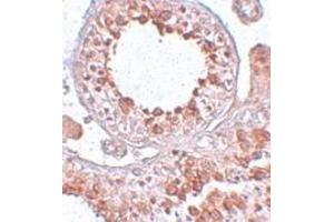 Immunohistochemistry (IHC) image for anti-ESX Homeobox 1 (ESX1) (Middle Region) antibody (ABIN1030926) (ESX Homeobox 1 antibody  (Middle Region))