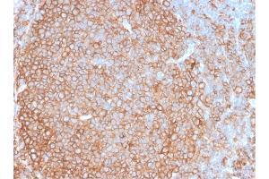 Immunohistochemistry (IHC) image for anti-MHC Class II HLA-DP/DQ/DR (HLA-DP/DQ/DR) antibody (ABIN6941452)