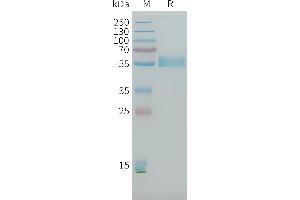 PLA2R1 Protein (AA 21-164, AA 223-359, AA 1097-1246) (His tag)