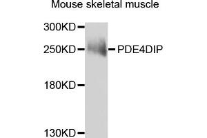 Western blot analysis of extracts of mouse skeletal muscle, using PDE4DIP antibody (ABIN5975638) at 1/1000 dilution. (PDE4DIP antibody)