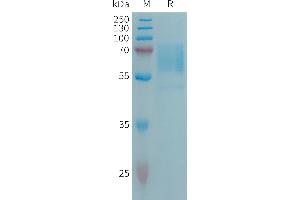 SLC3A2 Protein (AA 206-630) (His tag)