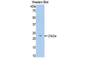 Detection of recombinant GKRP using Polyclonal Antibody to Glucokinase Regulatory Protein (GKRP) (GCKR antibody  (AA 90-286))