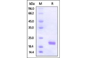 Human ROR1 (308-395, Kringle domain), His Tag on SDS-PAGE under reducing (R) condition. (ROR1 Protein (AA 308-395) (His tag))