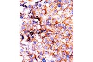 Image no. 2 for anti-Histone 3 (H3) (pSer10) antibody (ABIN358063) (Histone 3 antibody  (pSer10))