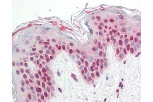 Anti-TFEB antibody IHC staining of human skin. (TFEB antibody  (N-Term))