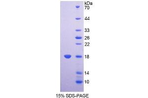 SDS-PAGE analysis of Mouse SDHD Protein. (SDHD Protein)