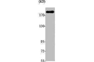 Western Blot analysis of A549 cells using Brm Polyclonal Antibody (SMARCA2 antibody  (Internal Region))