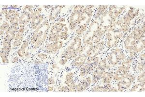 Immunohistochemical analysis of paraffin-embedded human stomach tissue. (Smad2/3 antibody)