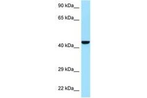 Image no. 1 for anti-GDP-Mannose Pyrophosphorylase B (GMPPB) (N-Term) antibody (ABIN6748267) (GMPPB antibody  (N-Term))