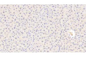 Detection of C5a in Rat Liver Tissue using Polyclonal Antibody to Complement Component 5a (C5a) (C5A antibody  (AA 12-64))