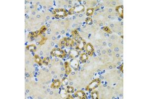 Immunohistochemistry of paraffin-embedded mouse kidney using PHPT1 antibody. (PHPT1 antibody)