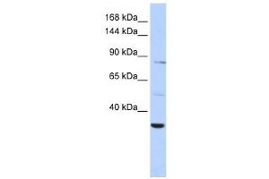 AHNAK2 antibody used at 1 ug/ml to detect target protein. (AHNAK2 antibody  (Middle Region))