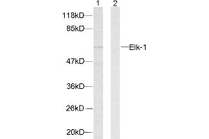 Western blot analysis of extracts from HeLa cells. (ELK1 antibody  (Ser383))