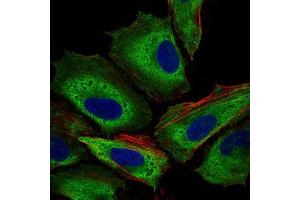 Immunofluorescence (IF) image for anti-Interleukin 3 Receptor, alpha (IL3RA) (AA 200-305) antibody (ABIN1724855)