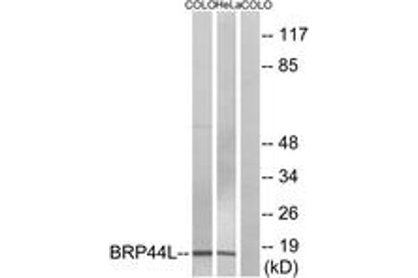 BRP44L antibody  (AA 11-60)