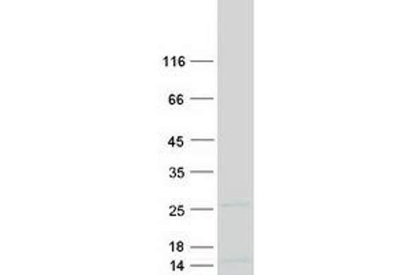 NDUFS4 Protein (Myc-DYKDDDDK Tag)