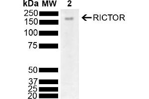 Western blot analysis of Mouse Brain showing detection of 192 kDa RICTOR protein using Rabbit Anti-RICTOR Polyclonal Antibody (ABIN5696192). (RICTOR antibody  (AA 1060-1160) (APC))