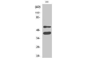 Western Blotting (WB) image for anti-Glycogen Synthase Kinase 3 alpha/beta (GSK3a/b) (Ser4520) antibody (ABIN3184956) (GSK3 alpha/beta antibody  (Ser4520))