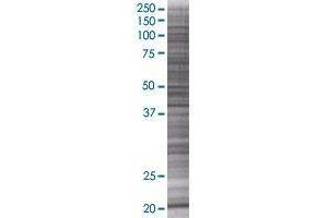 MED18 transfected lysate. (MED18 293T Cell Transient Overexpression Lysate(Denatured))