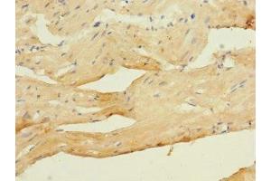 Immunohistochemistry of paraffin-embedded human heart tissue using ABIN7175582 at dilution of 1:100 (CACNA2D4 antibody  (AA 934-1115))
