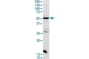 CHRDL2 MaxPab rabbit polyclonal antibody. (CHRDL2 antibody  (AA 1-451))