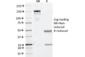 SDS-PAGE Analysis Purified CD20 Mouse Monoclonal Antibody (IGEL/773). (CD20 antibody)