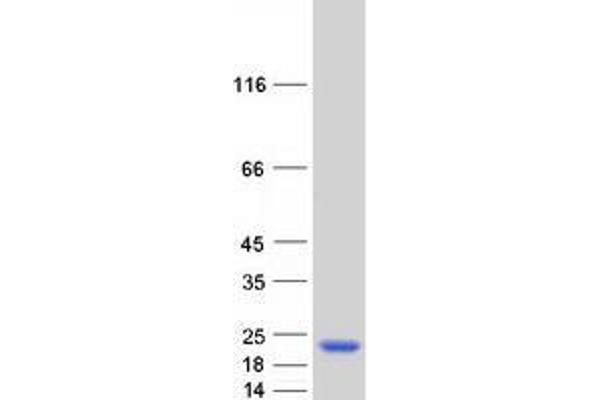 TRAPPC3 Protein (Myc-DYKDDDDK Tag)